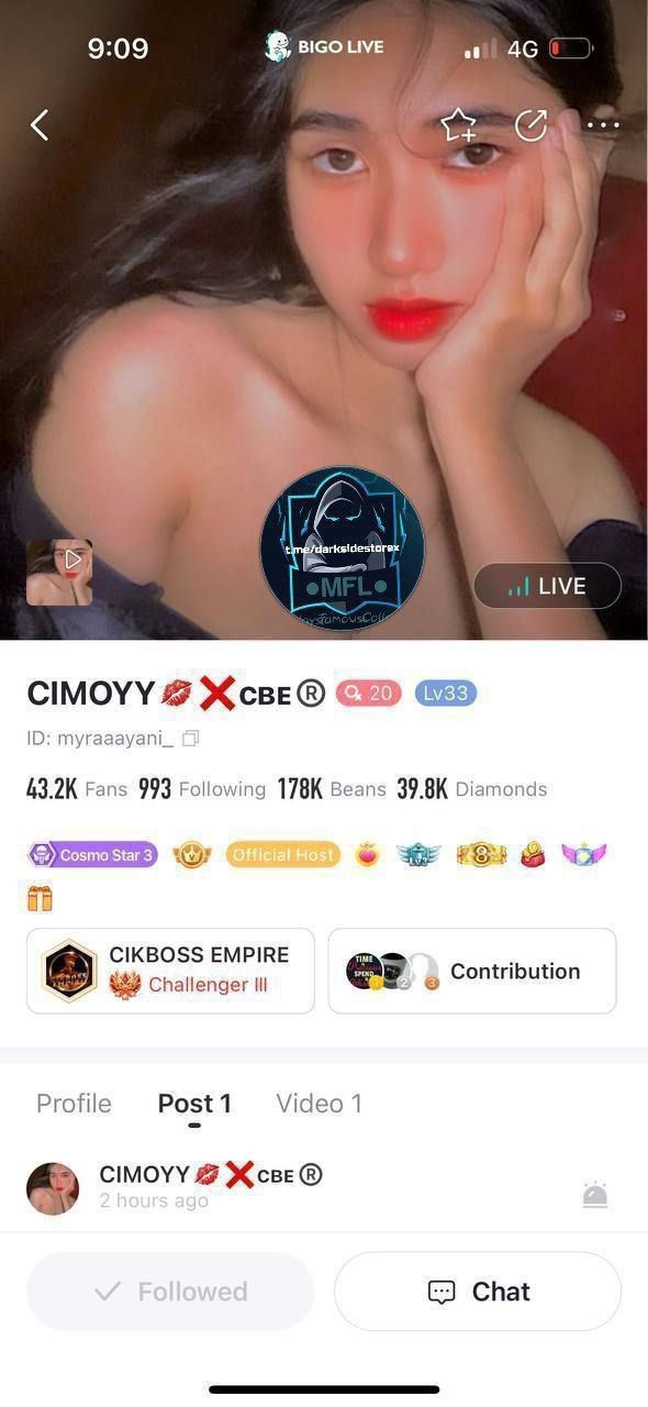 CIMOY BIGOPV